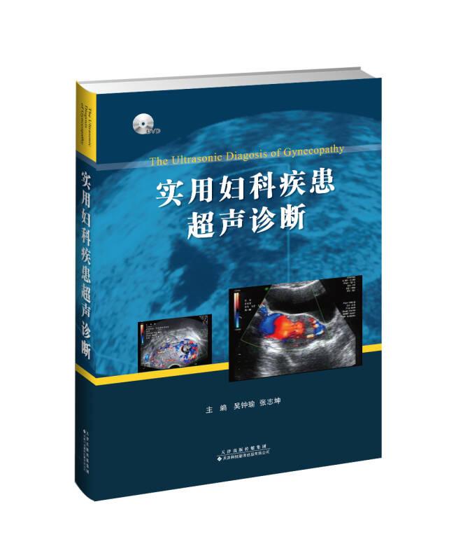 實(shí)用婦科疾患超聲診斷