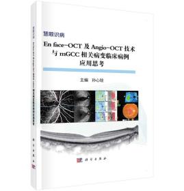 慧眼识病：Enface-OCT及Angio-OCT技术与mGCC相关病变临床病例应用思考