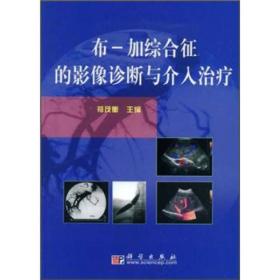 布-加综合征的影像诊断与介入治疗