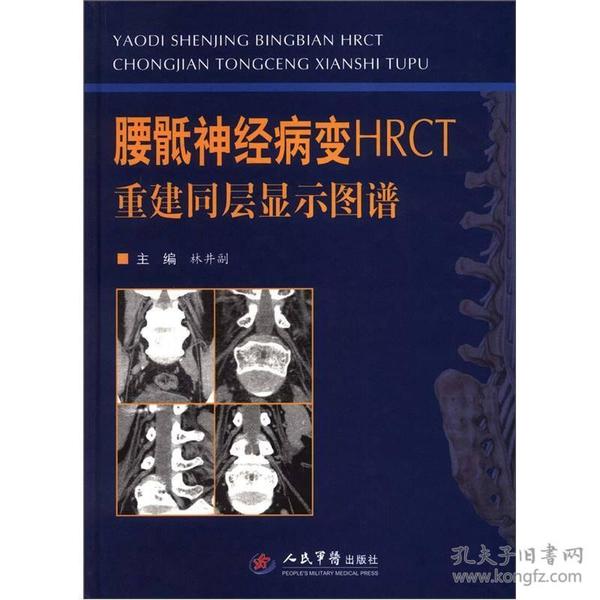 腰骶神经病变HRCT重建同层显示图谱