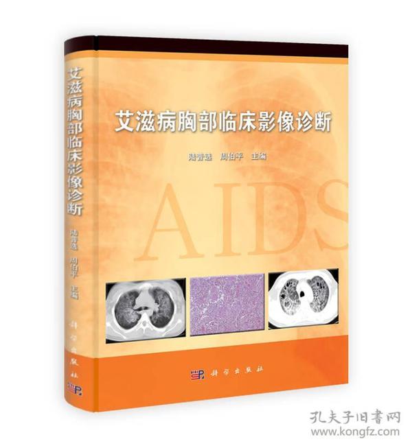 艾滋病胸部临床影像诊断