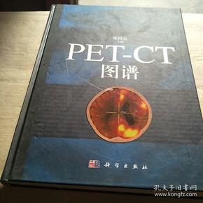 PET-CT图谱