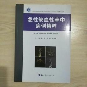 急性缺血性卒中病例精粹