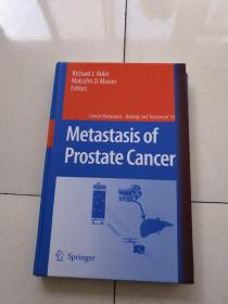 Metastasis of Prostate Cancer 前列腺癌转移