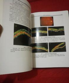 眼科临床光学相干断层成像学