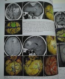 Translational Neuroscience and Clinics 临床转化神经医学(英文) 第2卷 第4期 2016年12月