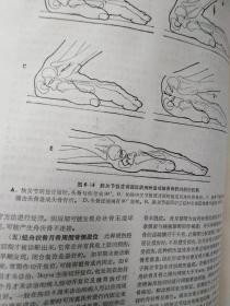 坎贝尔骨科手术大全上册