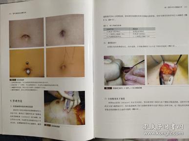 现代韩国乳房整形术