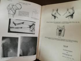 CHIRURGISCHE DIAGNOSTIK外科诊断（1931年德文原版书，大32开布面硬精装，全书内页基本全是插图和拉页图表，插图131页数百幅，拉页104页。制作精良，孔网惟一）