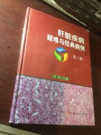 肝脏疾病疑难与经典病例  第二辑