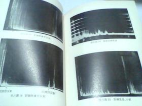 **医书  超声波诊断  后附许多图