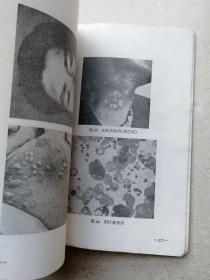 1963年《皮夫病及性病学》