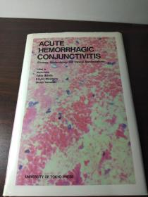 acute hemorrhagic conjunctivitis eitology epidemiology and clinical manifestations[急性出血性结膜炎的流行病学和临床表现]