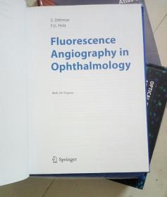 Fluorescence Angiography In Ophthalmology[荧光血管造影在眼科学]