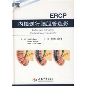 内镜逆行胰胆管造影（ERCP）