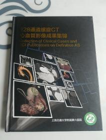 128通道螺旋CT心血管影像成果集锦
