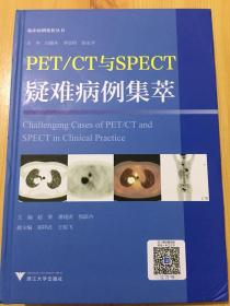 PET/CT,PET/MR与SPECT疑难病例集萃