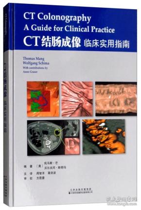 CT结肠成像：临床实用指南