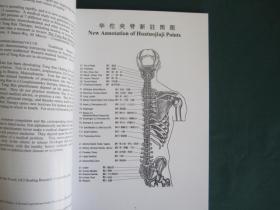 懒汉的疗法 :   铜人疗法简易取穴图表