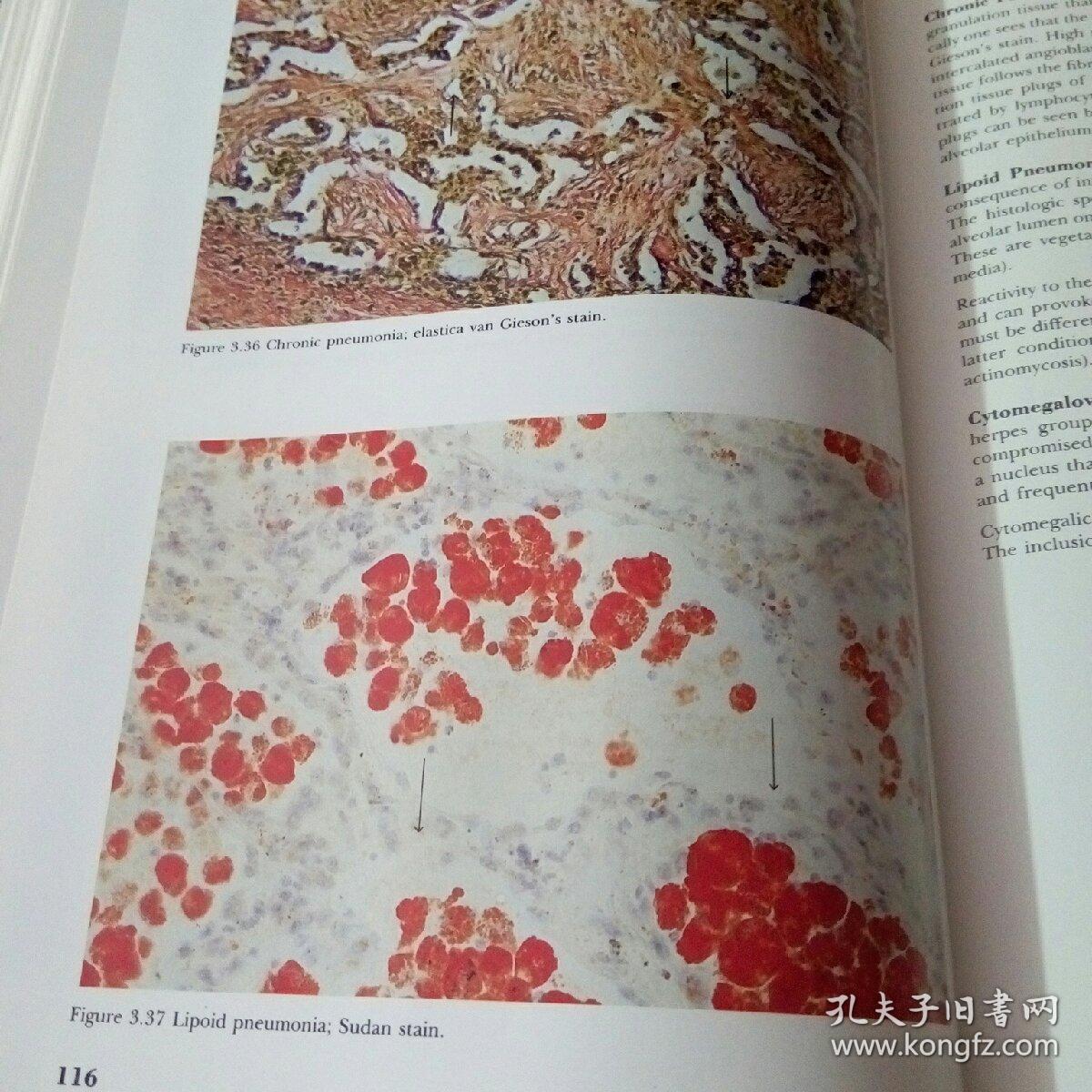 玉林年代壹号项目商业综合体全体的结构全面冲出正负零