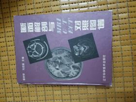 断面解剖与MRI CT ECT对照图谱.