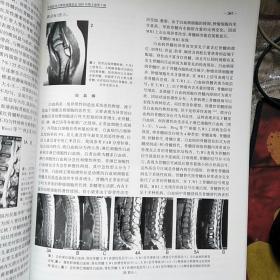 【【3本合售】中国医学计算机成像杂志2003年第9卷第3 4 5期（脑膜肿瘤影像学、骨与关节影像学进展）