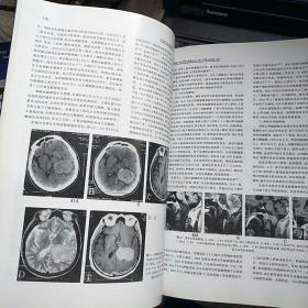 【【3本合售】中国医学计算机成像杂志2003年第9卷第3 4 5期（脑膜肿瘤影像学、骨与关节影像学进展）