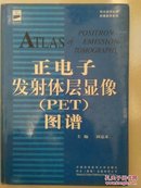 正电子发射体层显像(PET)图谱【精装】