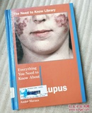 Everything Yntka Lupus (The Need to Know Library)
