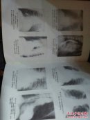 实用内科学（上下册）包邮