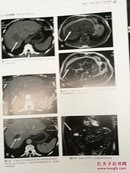 现代肝脏外科技术精要