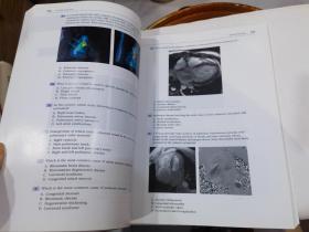 Cardiac Imaging: A Core Review 心脏成像，第2版，英文原版