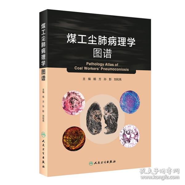 煤工尘肺病理学图谱