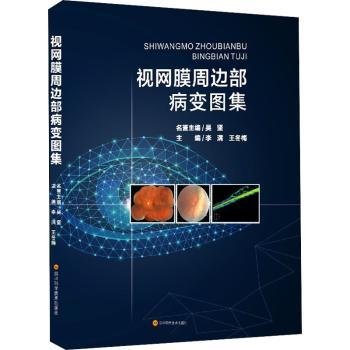 全新正版图书 视网膜周边部病变图集李满四川科学技术出版社9787572703591 视网膜疾病图集普通大众