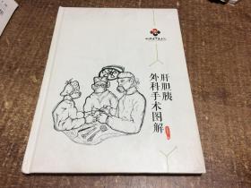 肝膽胰外科手術(shù)圖解  架687內(nèi)