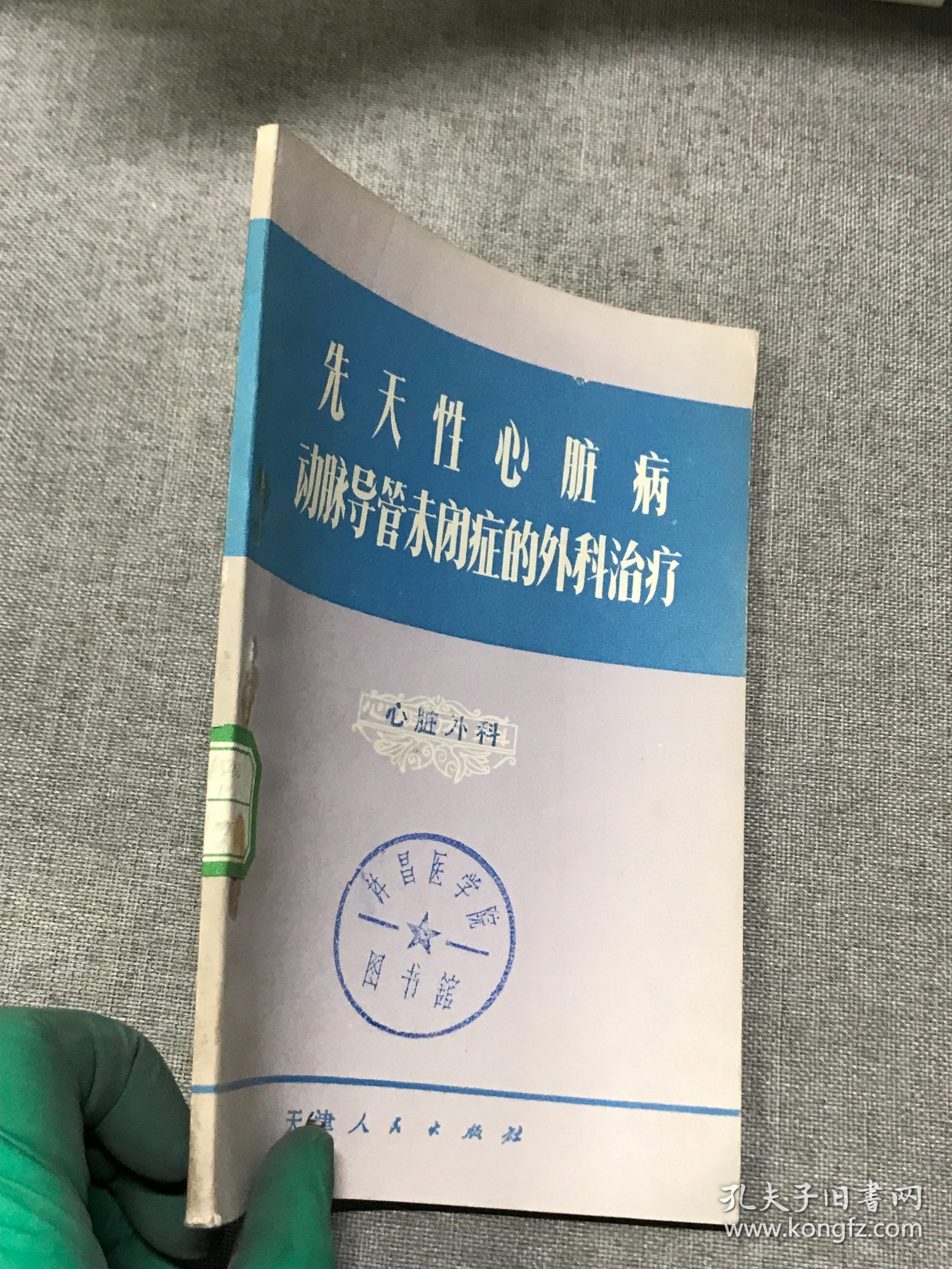 先天性心脏病动脉导管未闭症的外科治疗