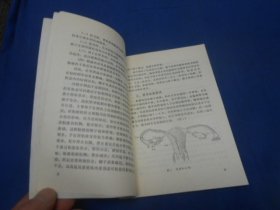 女性计划生育若干技术问题（插图本）（内页干净无字画）