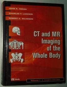 ★英文原版书 CT and MR Imaging of the Whole Body Volume 1