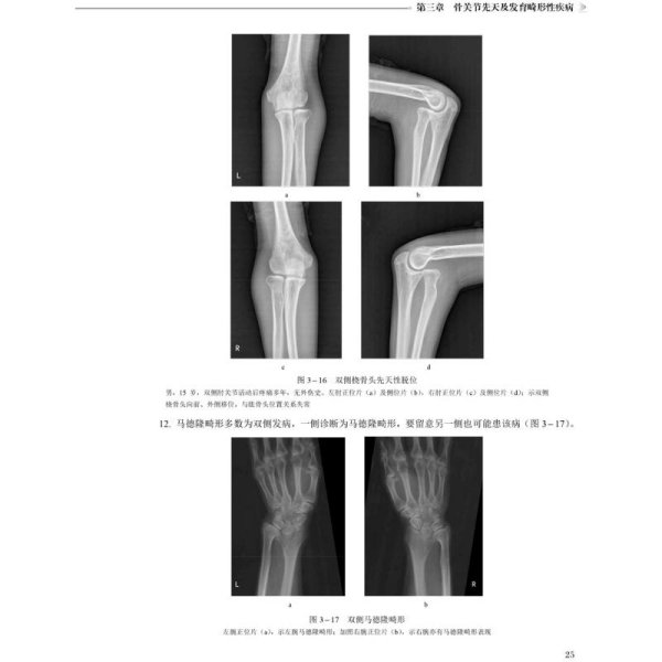 肌骨系统影像诊断实战经验集要