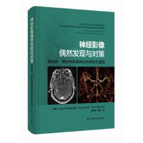 神经影像偶然发现与对策 放射科、神经外科和神经内科医生指南