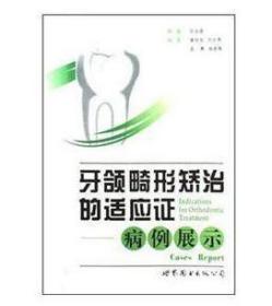 牙颌畸形矫治的适应证：病例展示