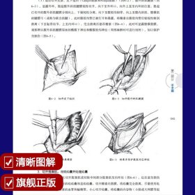 腹股沟疝手术策略与技巧 全彩图解 腹股沟股疝治疗方法 普外科医生书籍 外科手术学 整形外科学 普通外科腹腔镜手术图谱