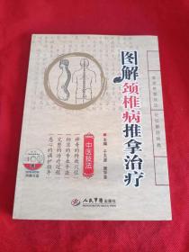 图解颈椎病推拿治疗