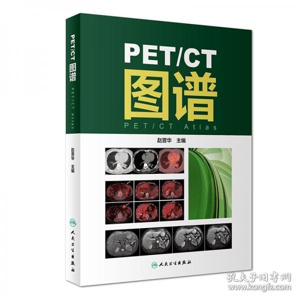 PET/CT图谱