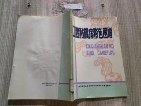 口腔粘膜病彩色图谱