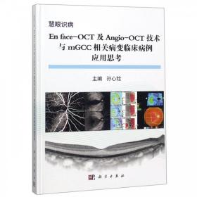 En face-OCT及Angio-OCT技术与mGCC相关病变临床病变应用思考