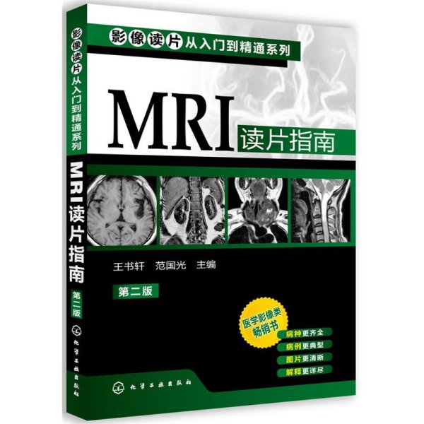 影像读片从入门到精通系列：MRI读片指南（第2版）