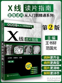 影像读片从入门到精通系列：X线读片指南（第2版）