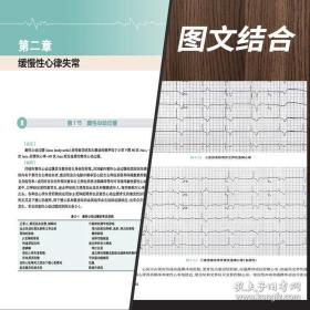 实用心律失常学（第2版）