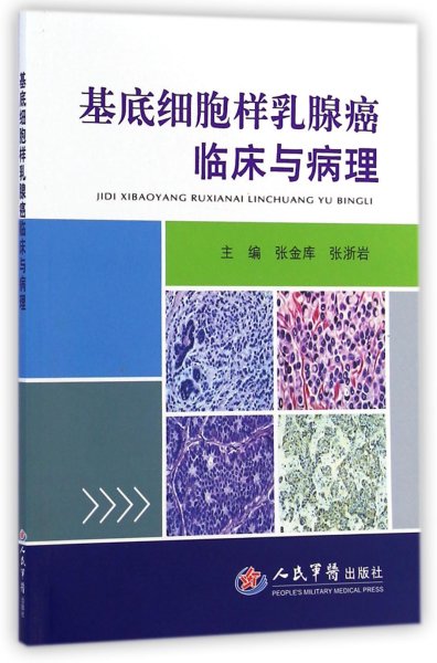 基底细胞样乳腺癌临床与病理